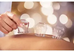 Cupping Therapy NYC