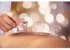 Cupping Therapy NYC