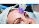 Best Treatment For RF Microneedling in Wanstead