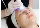 Best LED Therapy Facial in Aylestone Park